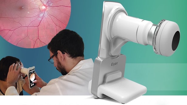 eyer-smartphone-retinal-examination-2.jpg