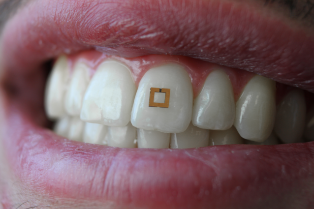 20180321ToothSensor.png