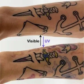 1Arm-tattoo-with-and-without-light-CREDIT-Matter-and-Light,-Bruns-et-al.jpg.webp